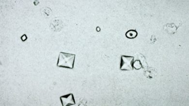 Calcium Oxalate Crystals